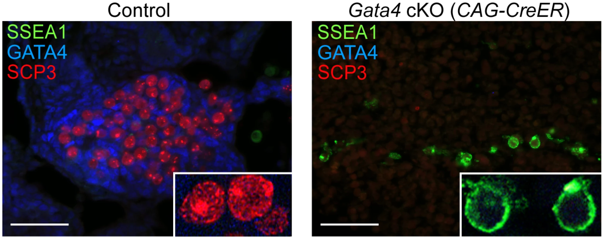 Germ cells in <i>Gata4</i> cKO embryos do not enter meiosis.
