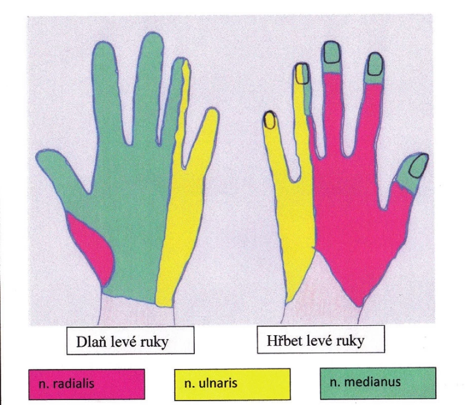Distribuční oblasti senzitivních vláken nervů ruky