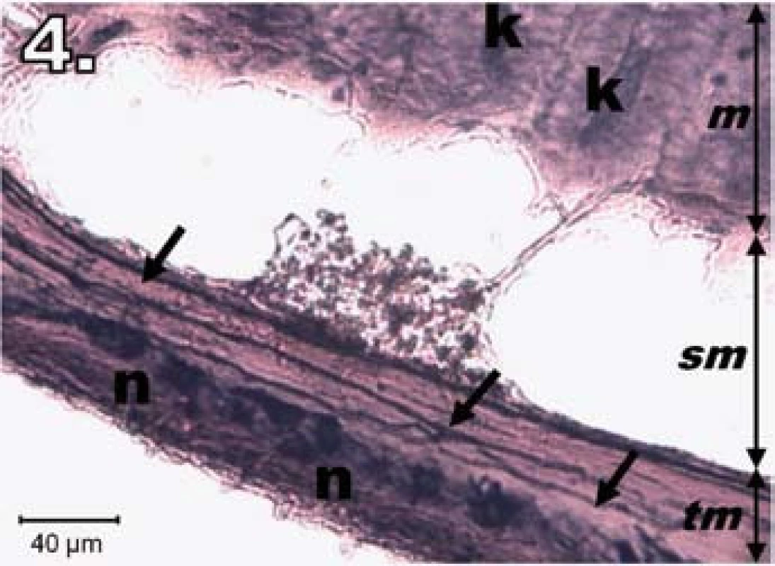 Histologický obraz jejuna v skupine R30. n – NADPH-d pozitívne neuróny opäť silne pozitívne, šípky – nervové vlákna silne pozitívne, k – Lieberkühnove krypty pozitívne, m – mukóza, sm – submukóza, tm – tunica muscularis; scale bar = 40 μm
Fig. 4. Histological picture of jejunum in group R30. n – neurons fully NADPH-d positive, arrows – positive nerve fibres, k – positivity in Lieberkühn's crypts, m – mucosa, sm – submucosal layer, tm – tunica muscularis; scale bar = 40 μm