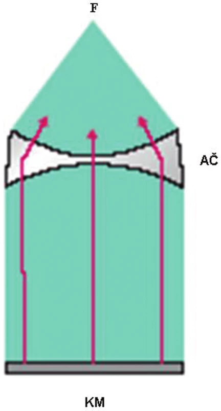 Elektromagnetický generátor. F–ohnisko rázových vln, AČ–akustický systém čoček, KM–kovová membrána.