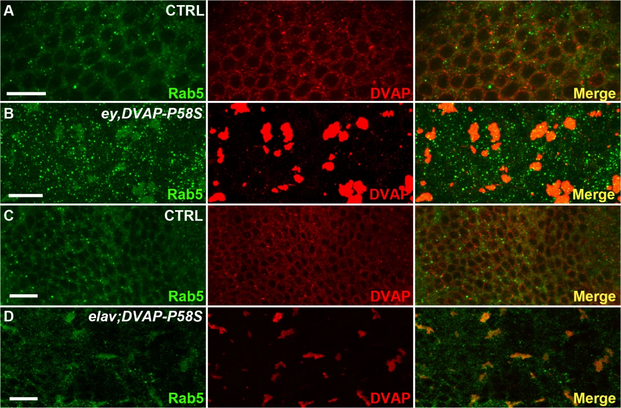 Abnormal accumulation of Rab5 in larval eye imaginal discs and brains expressing <i>DVAP-P58S</i>.