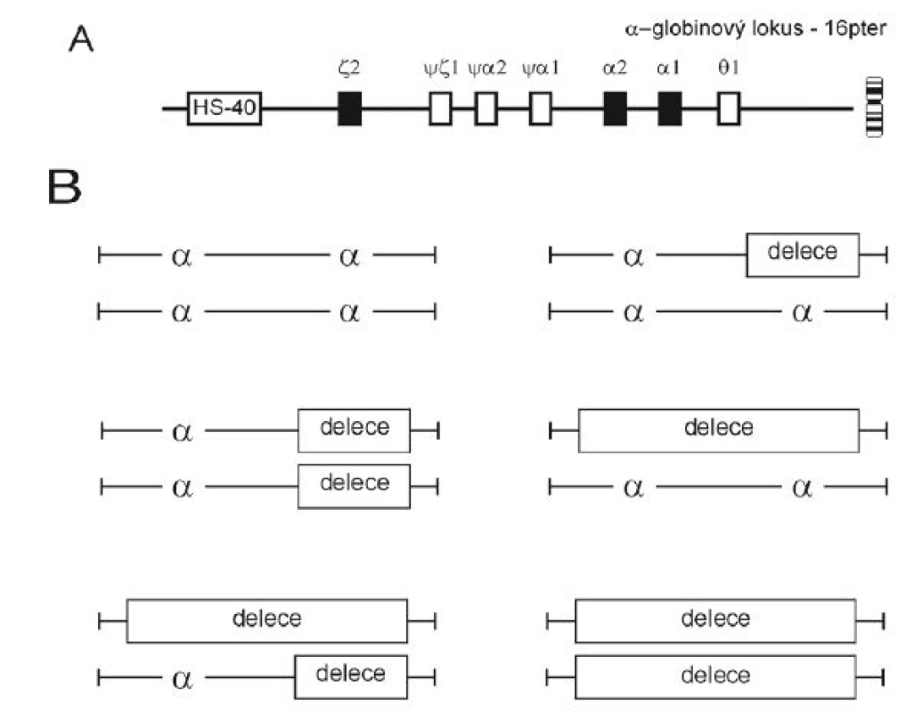 Struktura α-globinového lokusu na chromozomu 16 a genotypové varianty delečních α-talasemií 
A. Rodina (klastr) α-globinových genů leží v lokusu v blízkosti telomery na chromozomu 16. Klastr je dlouhý 29 kb a obsahuje embryonální gen z a dva α-globinové geny fetálního a dospělého typu α2 neboli <i>HBA2</i> a α1 neboli <i>HBA1</i> (plné boxy), které jsou uspořádány na chromozomu ve směru jejich exprese během ontogeneze. Exprese těchto genů je řízena erytroidně-specifickou regulační oblastí, která leží 40 kb proti směru exprese ζ-globinového genu a nazývá se pozitivní regulační oblast HS-40. Prázdné boxy značí nefunkční kopie genů – pseudogeny. Alfa-globinový lokus se nachází v transkripčně-permisivní chromatinové oblasti, to znamená, že se nachází v trvale otevřené chromatinové doméně a HS-40 oblast působí jako zesilovač globinové exprese.
B. Nahoře vlevo: normální diploidní genotyp. Nahoře vpravo: heterozygot pro α<sup>+</sup>-talasemii, tzv. němé (nebo tiché) nosičství. V krevním obraze a v poměru syntézy α : β globinových řetězců se prakticky neprojevuje a prokazujeme je jen při genetické analýze. Uprostřed: u homozygotů pro α<sup>+</sup>-talasemii (nejčastěji delece dvou genů, –α/–α) nebo u heterozygotů pro α<sup>0</sup>-talasemii (– –/αα) hovoříme 
o nosičství α-talasemie. Projevuje se mírnou mikrocytózou, zvýšeným počtem erytrocytů 
a nerovnováhou v syntéze globinových řetězců. Dole vlevo: ztráta tří α-globinových genů (dvojití heterozygoti pro α<sup>+</sup>-talasemii a α<sup>0</sup>-talasemii, nejčastěji – – /–α), vede k chorobě HbH se středně těžkou chudokrevností a s produkcí HbH (β4). Při inkubaci s briliant-kresylovou modří nacházíme 
v erytrocytech precipitovaný HbH.
Dole vpravo: chybění čtyř α-globinových genů, tj. homozygotní stav pro α<sup>0</sup>-talasemii (– –/– –), není slučitelné s životem a vede ke vzniku <i>hydrops fetalis</i> nebo syndromu Hb Bart’s (g4). Rodí se hydropicky změněné dítě s ascitem, velkými játry, erytroblastózou, retikulocytózou, terčovitými buňkami s převažujícím Hb Bart’s a malým podílem HbH a Hb Portland (z2g2).