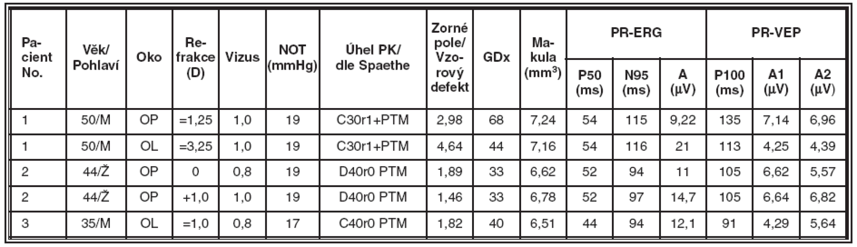 Skupina nemocných s primárním glaukomem s otevřeným úhlem (POAG), souhrnné výsledky jednotlivých typů vyšetření v této skupině
