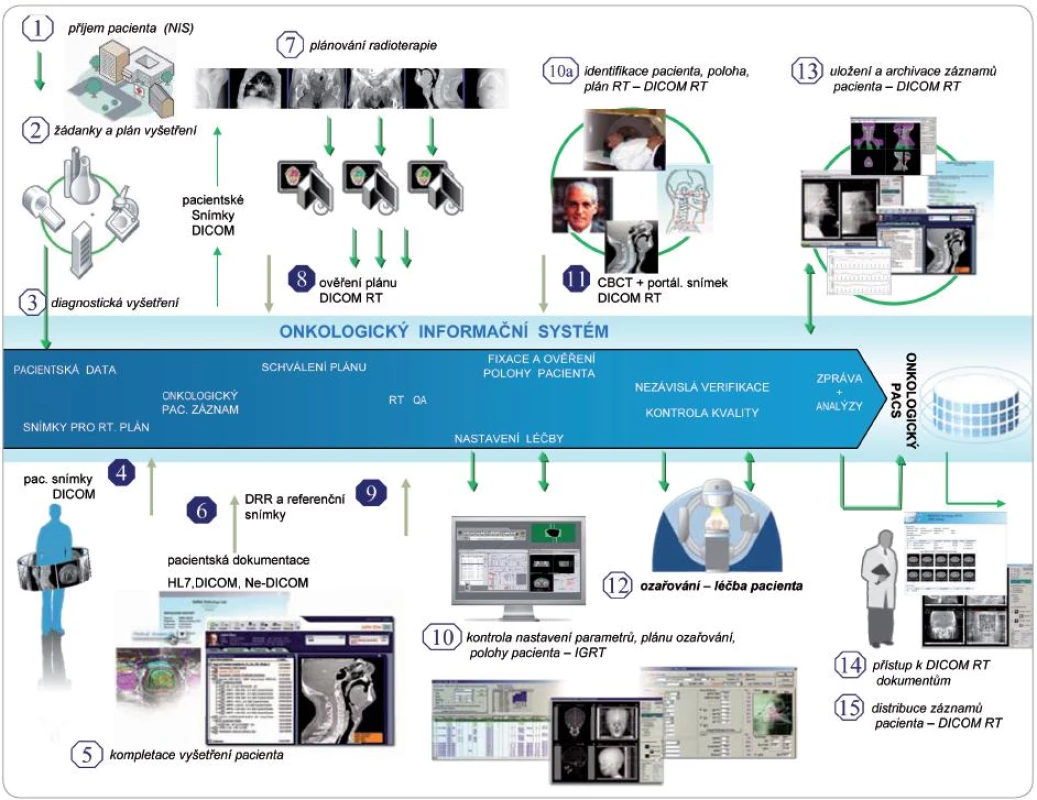 Obrázkové schéma popisuje obecné procedury zahrnuté v plánování radioterapie a vlastní radioterapii současně s datovými toky pacientských a obrazových informací.