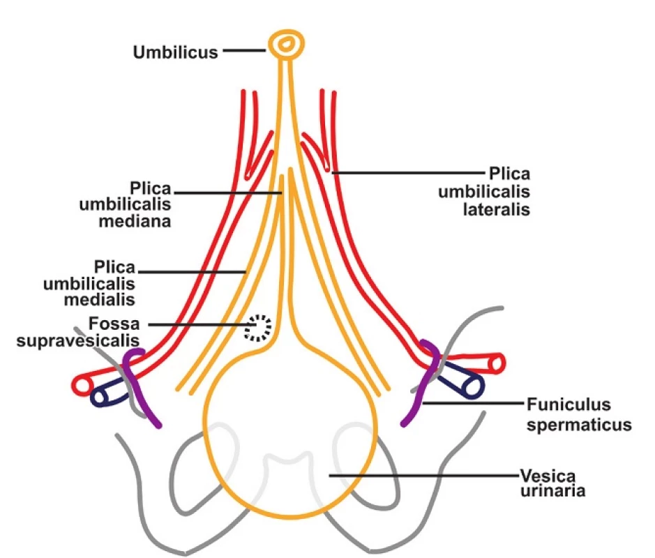 Supravezikální jamka
Fig. 3: Fossa supravesicalis