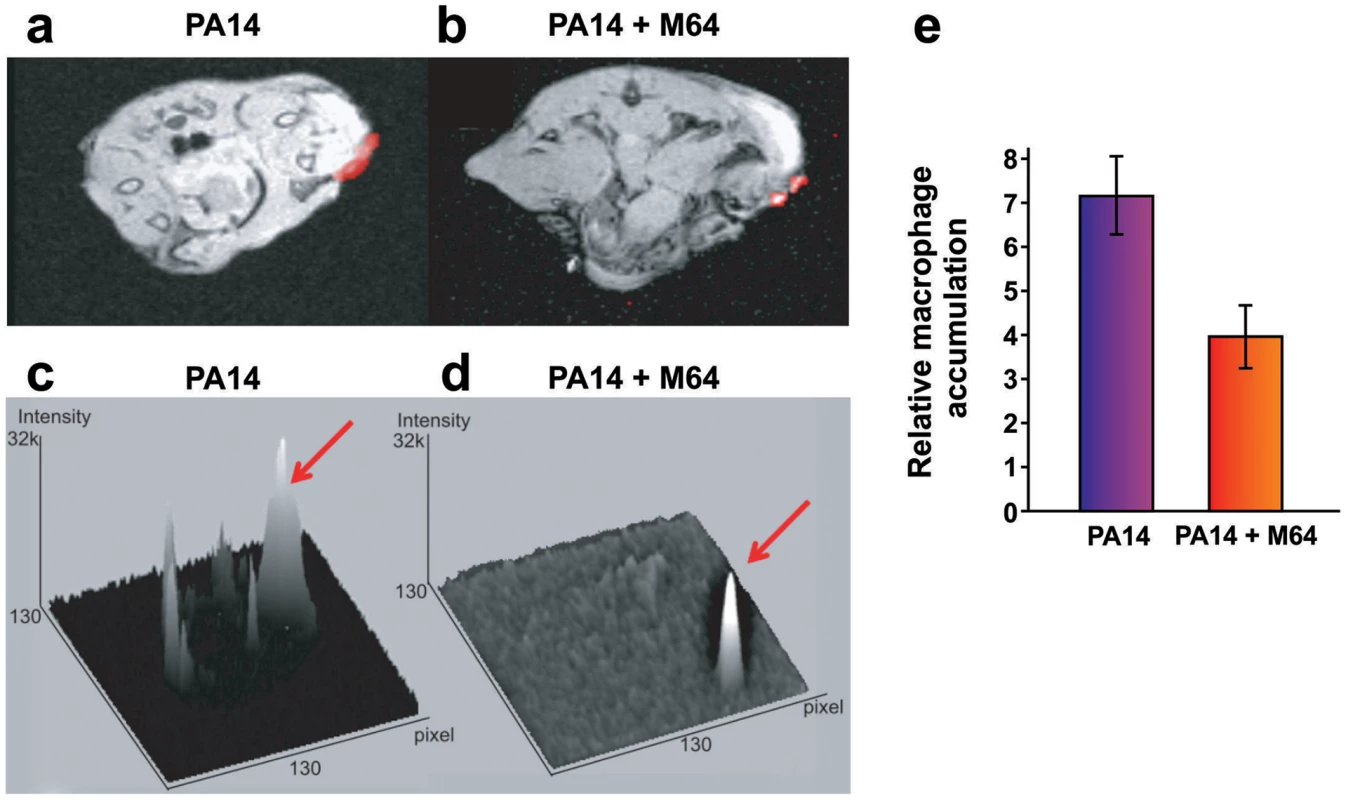 Magnetic resonance imaging of M64 inhibition of macrophage recruitment at a burn and infection site.