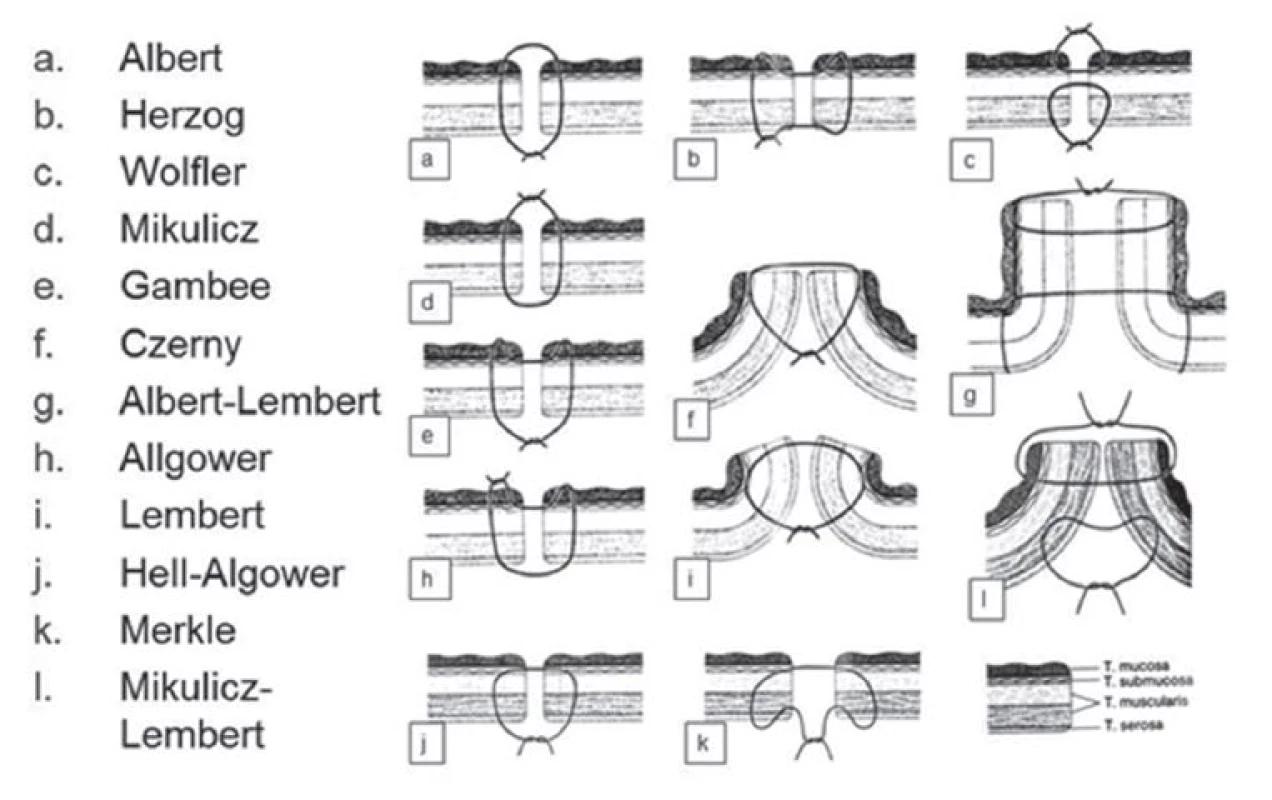Přehled základních šicích technik při konstrukci střevní anastomózy dle jejich tvůrců
Fig. 1: Overview of essential suture techniques for bowel anastomosis construction according to orginal authors