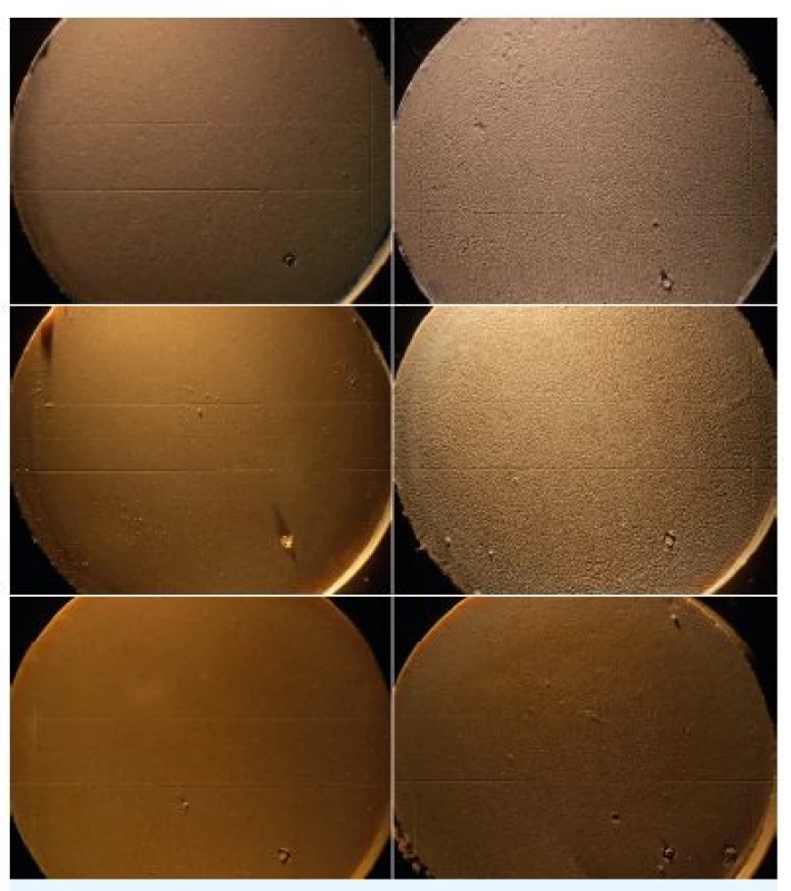 Kvalita povrchu a reprodukce 50mm rýhy sádrových modelů odlitých z kontrolních vzorků (vlevo) a ze zkušebních vzorků po jejich dezinfekci v přípravku Dentaclean Form (vpravo); nahoře – sádrové modely vzorků z otisk. hmoty Ypeen, uprostřed – sádrové modely vzorků z Alligat fast set, dole – sádrové modely vzorků z Elastic Cromo; zvětšení 6,3x