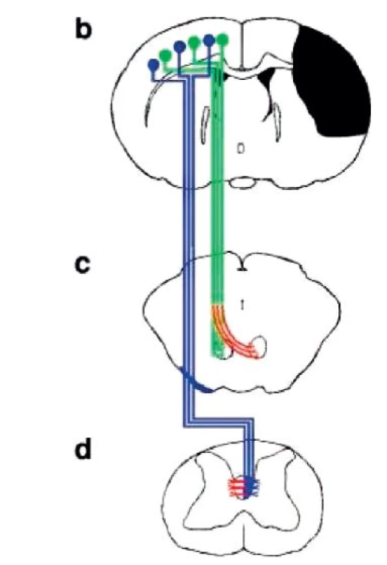 Schematické znázornění kortikospinální a kortikobulbární dráhy a jejich zkříženého sproutingu. (Převzato Chen, 2002.)