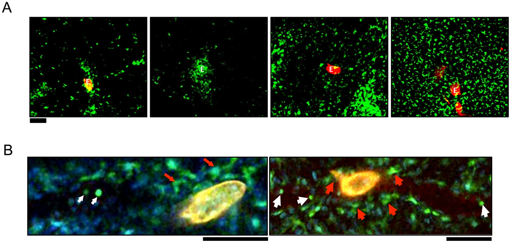 CX<sub>3</sub>CR1-GFP<sup>+</sup> cells accumulate in the hepatic granulomas around <i>S. mansoni</i> eggs.