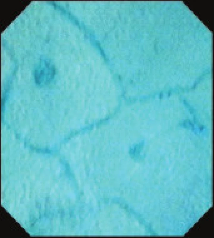 Endocytoskopický obraz normální sliznice kolon.