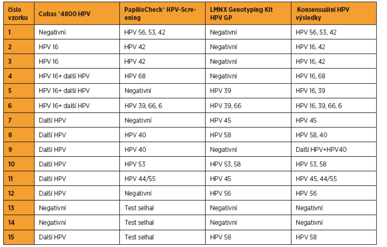 Analýza HPV statusu, u nichž se výsledky testu systémem Cobas<sup>®</sup>  4800 HPV 
a PapilloCheck<sup>®</sup> HPV-Screening neshodovaly nebo analýza PapilloCheck<sup>®</sup> HPV-Screening selhala