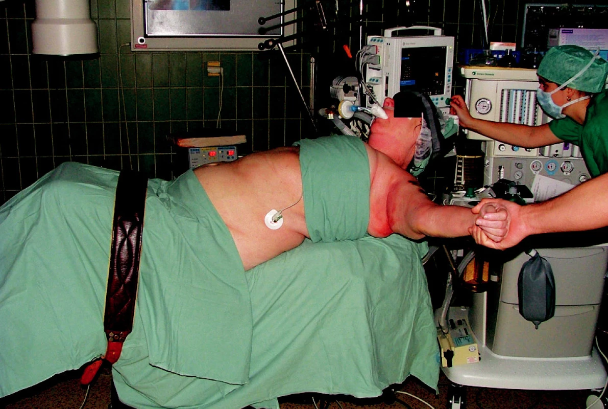 Foto – poloha pacienta na operačním stole před zahájením operace
Fig. 9. A patientes positioning on the operating table prior to surgery