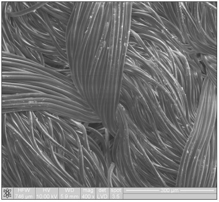 Obraz PET (polyetylén tetraftalát) cévní protézy ve skenovacím elektronovém mikroskopu. NOVA nanoSEM
200, FEI, USA, měřítko = 300 μm