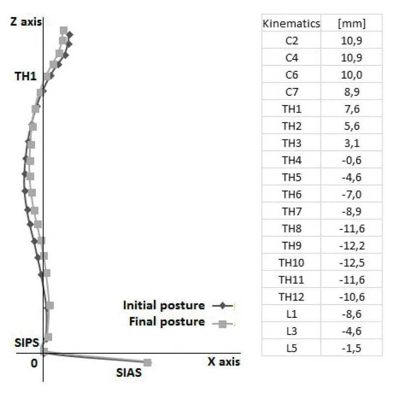 A) Průměrná změna držení trupu – rozdíl mezi počáteční (initial posture) a konečnou (final posture) polohou, osa Z, X (axis Z, X); B). Průměrné hodnoty jednotlivých segmentů páteře – změna kinematických dat.