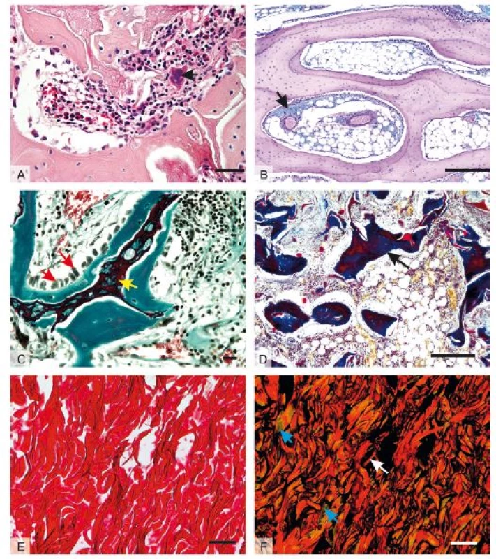 Mikrofotografie orgánů za použití přehledných barvících metod: 1A – mnohojaderná obří buňka z cizích těles (černá šipka) v hojící se kosti králíka, barveno HE, měřítko 20 μm; 1B – glykosaminoglykany v pojivové tkáni (černá šipka) kosti králíka, barveno alcianovou modří + PAS, měřítko 500 μm; 1C – osteoblasty (červené šipky) na povrchu novotvořeného kostního trámce (zeleně) obrůstajícího reziduální část tkáňového nosiče (žlutá šipka) v kosti králíka, barveno modifikovaným zeleným trichromem, měřítko 20 μm; 1D – kostní trámec (černá šipka), v hojícím se defektu barveno Malloryho trichromem, měřítko 500 μm; 1E – kolagenní vlákna hojící se dermis kůže králíka v procházejícím světle, barveno pikrosiriovou červení, měřítko 100 μm; 1F – identické zorné pole, polarizované světlo rozlišuje červená a žlutá kolagenní vlákna typu I (bílá šipka) a zelené fibrily kolagenu typu III (modrá šipka), měřítko 50 μm