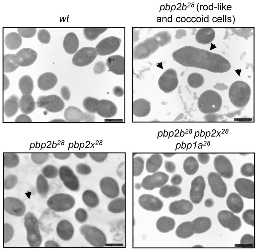 Electron microscopy analysis of cell morphology of <i>pbp</i> mutants.