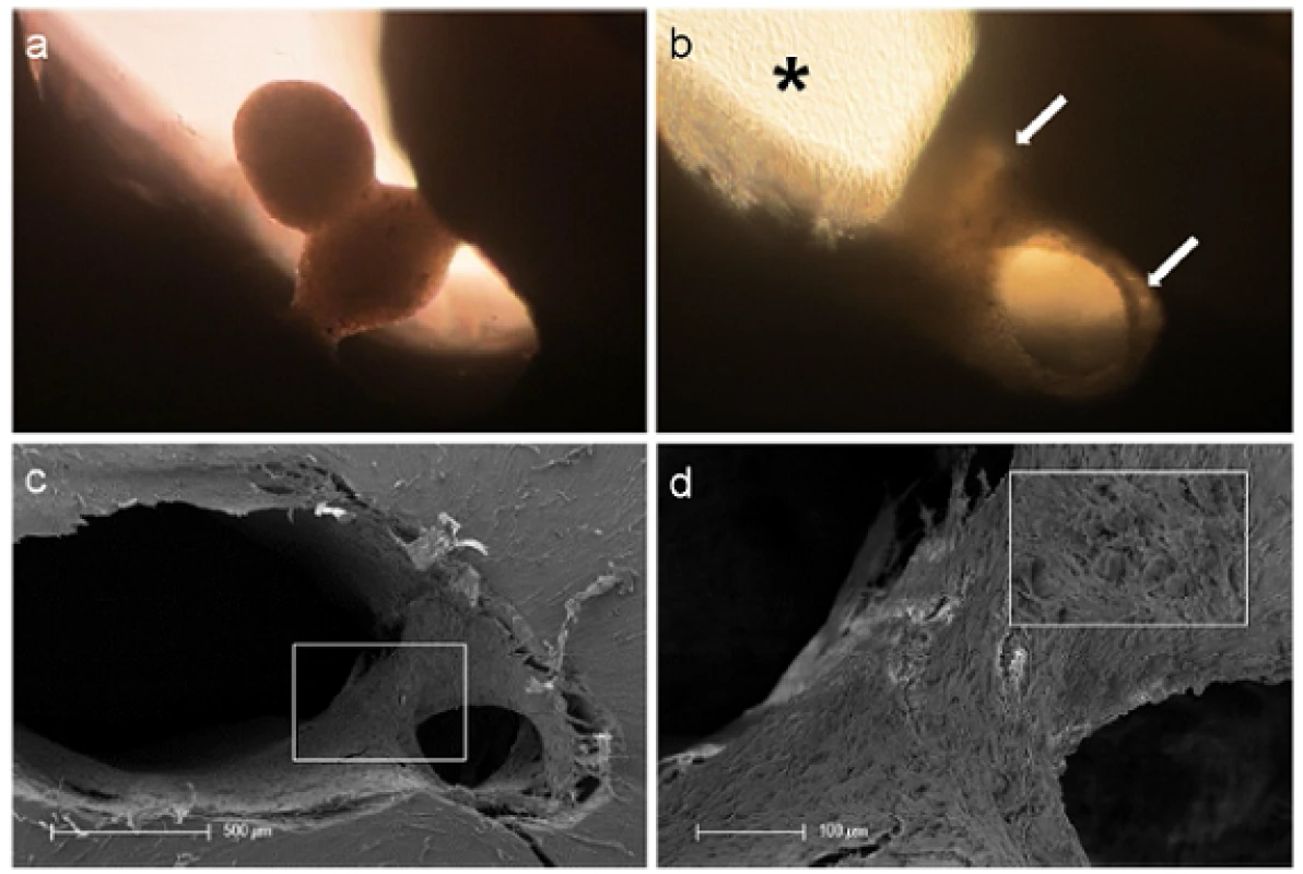 Tissue-like behavior of human pulp sphere cells. Figure (a) shows merging pulp-spheres in a human root canal model after five days. After 28 days of cultivation the two spheres merged, cells grew out of the spheres and coated the root dentin walls (white arrows). (b) Outgrowing cells also covered the underlying polystyrene culture dish and built up a dense cell layer (black asterisk). SEM investigation of the merged spheres (c and d) represents the even surface of the new cell construct and the widespread coverage of the root canal walls (c) as well as the randomly distributed different sized particles (d).