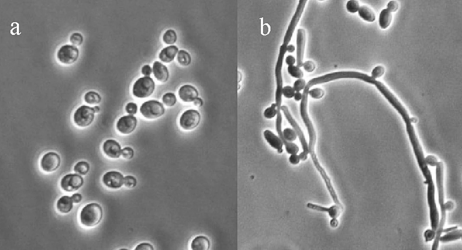 Candida albicans: a) kvasinka jako oválná buňka, b) pseudohyfy&lt;sup&gt;19&lt;/sup&gt;)