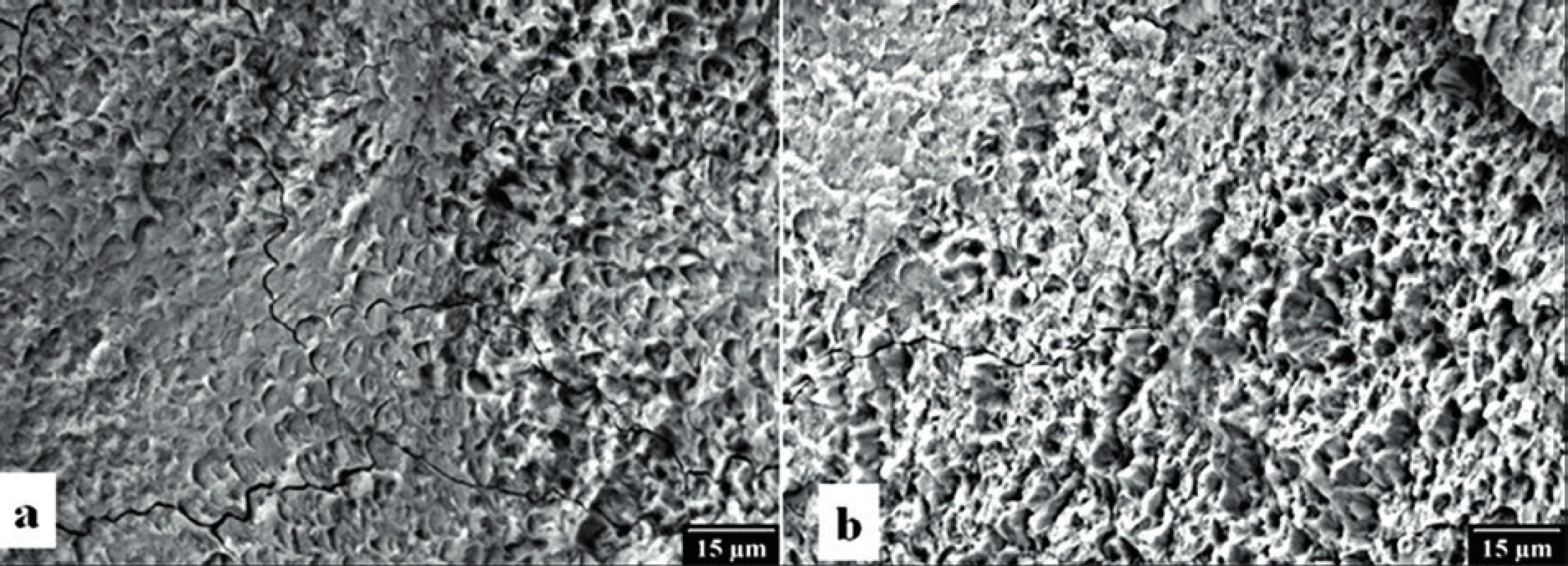 Povrch skloviny po kontaktní (a) a nekontaktní (b) laserové preparaci v elektronovém rastrovacím mikroskopu