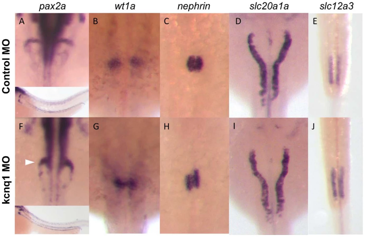 Kcnq1 knockdown in zebrafish embryos causes glomerular abnormalities.