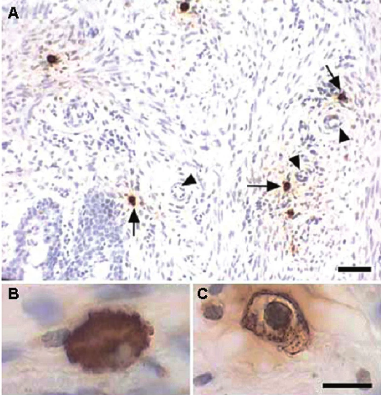 Imunohistochemická detekce žírných buněk v děložním krčku potkana: A – pozitivně značené buňky (šipky) 12. den těhotenství lokalizované v okolí cév (trojúhelníky), B – naplněné buňky bez známek degranulace, C – degranulované buňky s vyprázdněnými částmi cytoplazmy (Bosquiazzo et al. Reproduction 2007; 133: 1045–1055. Reproduced by permission.)