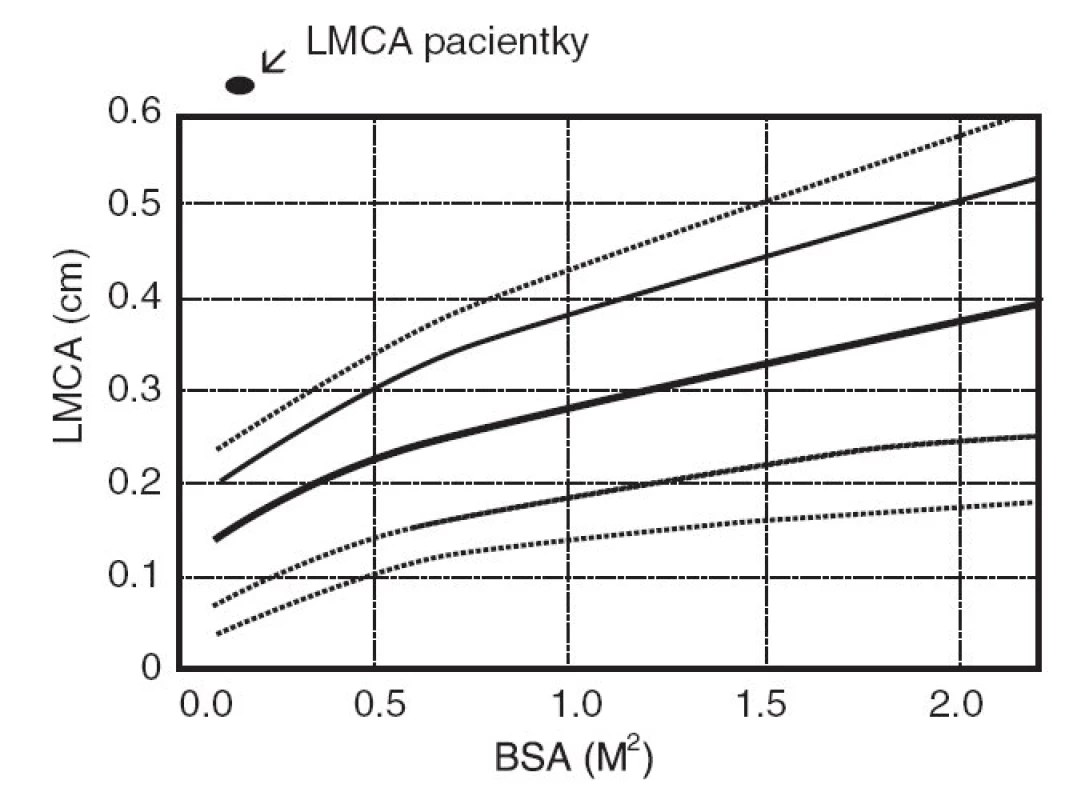 Šíře hlavního kmene levé koronární arterie (LMCA) vztažená na povrch těla (BSA).
Fig. 2. Range of the main stem of the left coronary artery (LMCA) with relation to body (BSA).