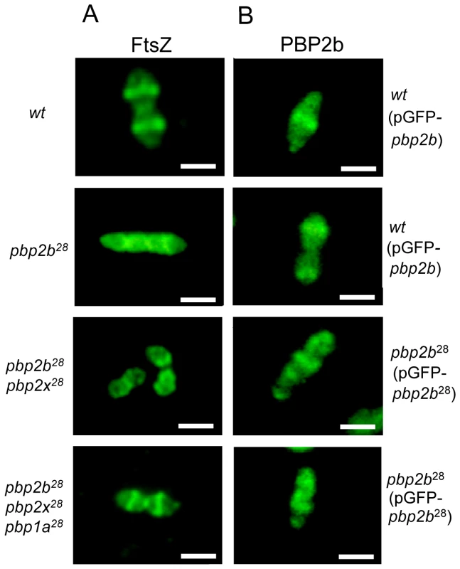 Protein localization in wild-type and <i>pbp</i> mutants by fluorescence microscopy.