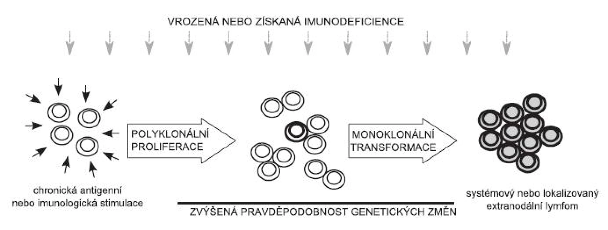 Schéma možného vývoje maligních lymfoproliferací založeného na chronické antigenní stimulaci: Chronická antigenní nebo imunologická stimulace vede ke zvýšené proliferaci velkého počtu klonů lymfocytů. Pokud dojde v jedné buňce (několika buňkách) k nahromadění mutací vedoucích k její nádorové transformaci, vzniká klon (případně několik klonů) nádorových lymfocytů, který dá vznik malignímu lymfomu. Za podmínek vrozené nebo získané imunodeficience se proces lymfomageneze výrazně zrychluje.
