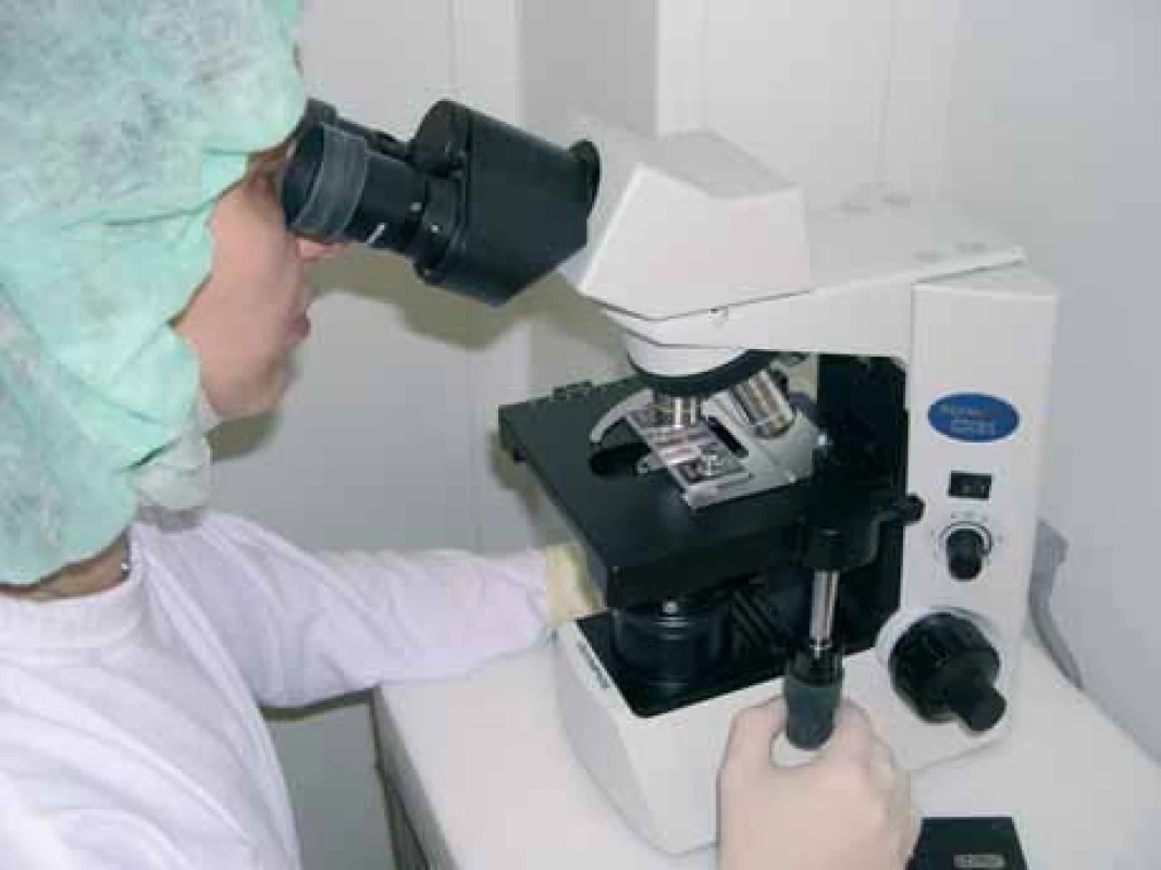 Mikroskopické vyšetření PuK – stanovení počtu jaderných buněk.