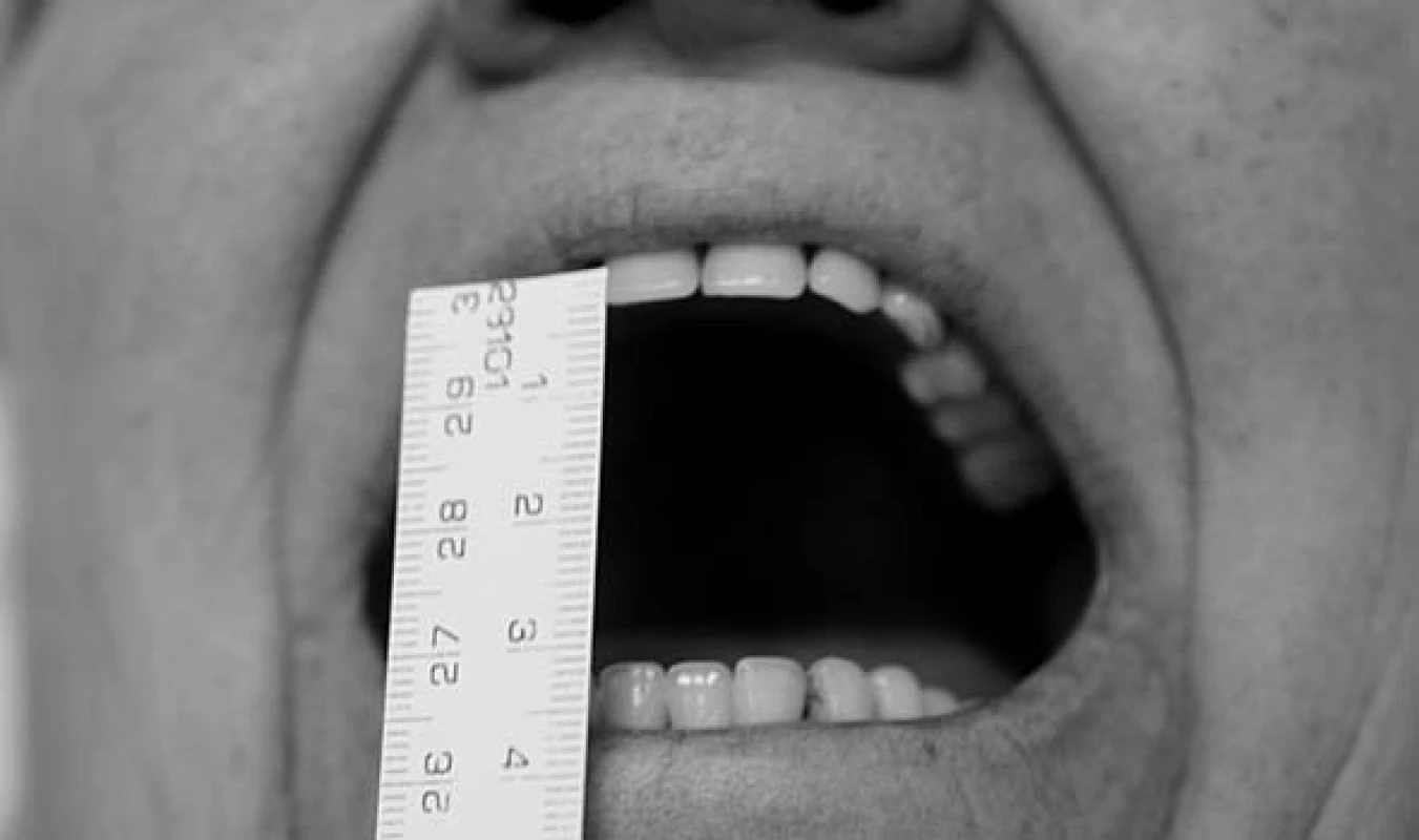 Měření maximálního otvírání úst