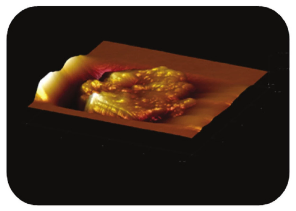 Trojrozměrné zobrazení AFM skenu magnetického nosiče PGMA-COOH zanořeného v agarové vrstvě. Z obrázku je zřejmé, že jde o topografii celé částice, zobrazení: výškový profil, skenovaná oblast 8x8 μm&lt;sup&gt;2&lt;/sup&gt;, Z-rozsah 1,1 μm. 