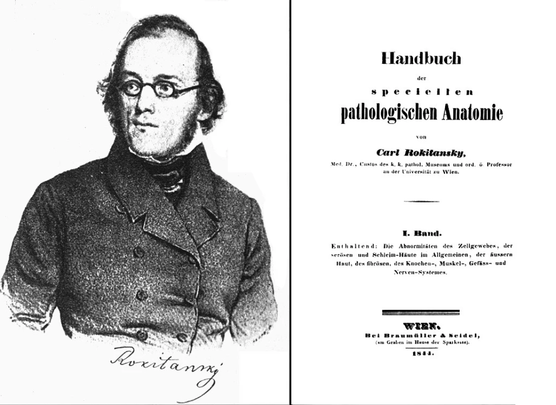 Rokitanský na litografii z roku 1839 a titulní strana jeho monografie