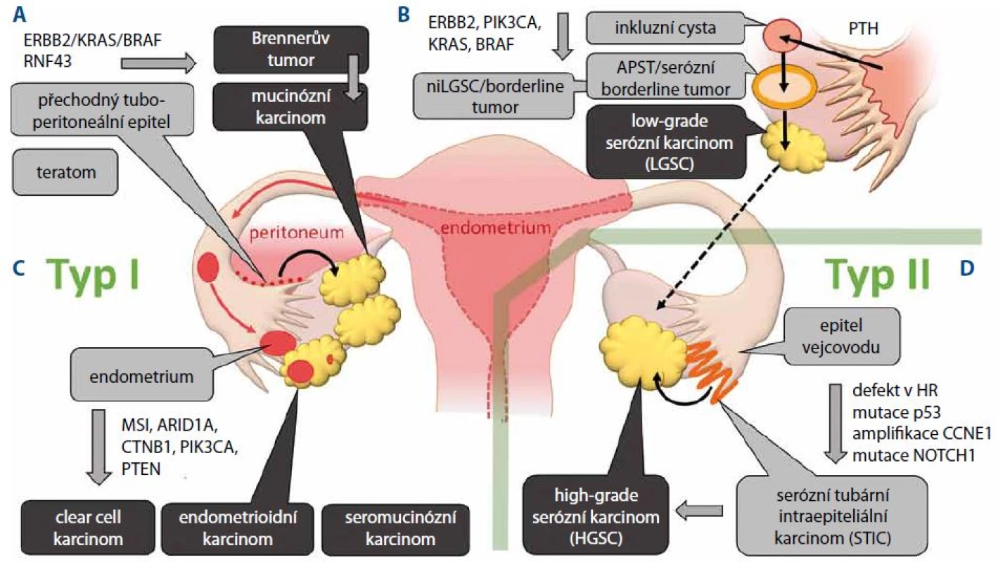 Kancerogeneze epiteliálních nádorů ovaria z prekurzorových lézí.
A. Vývoj mucinózního karcinomu z metaplastického epitelu v oblasti tubo-peritoneálního spojení. B. Vývoj low-grade serózních karcinomů z primární tubární hyperplazie přes kortikální inkluzní cystu (CIC) a atypický proliferativní tumor (APST). C. Na podkladě endometriózy dochází k vytváření clear cell karcinomů, endometrioidních karcinomů a seromucinózních karcinomů. D. Nádory typu II reprezentuje zejména high-grade serózní karcinom vznikající v epitelu fimbrií vejcovodu jako serózní tubární intraepiteliální karcinom (STIC).