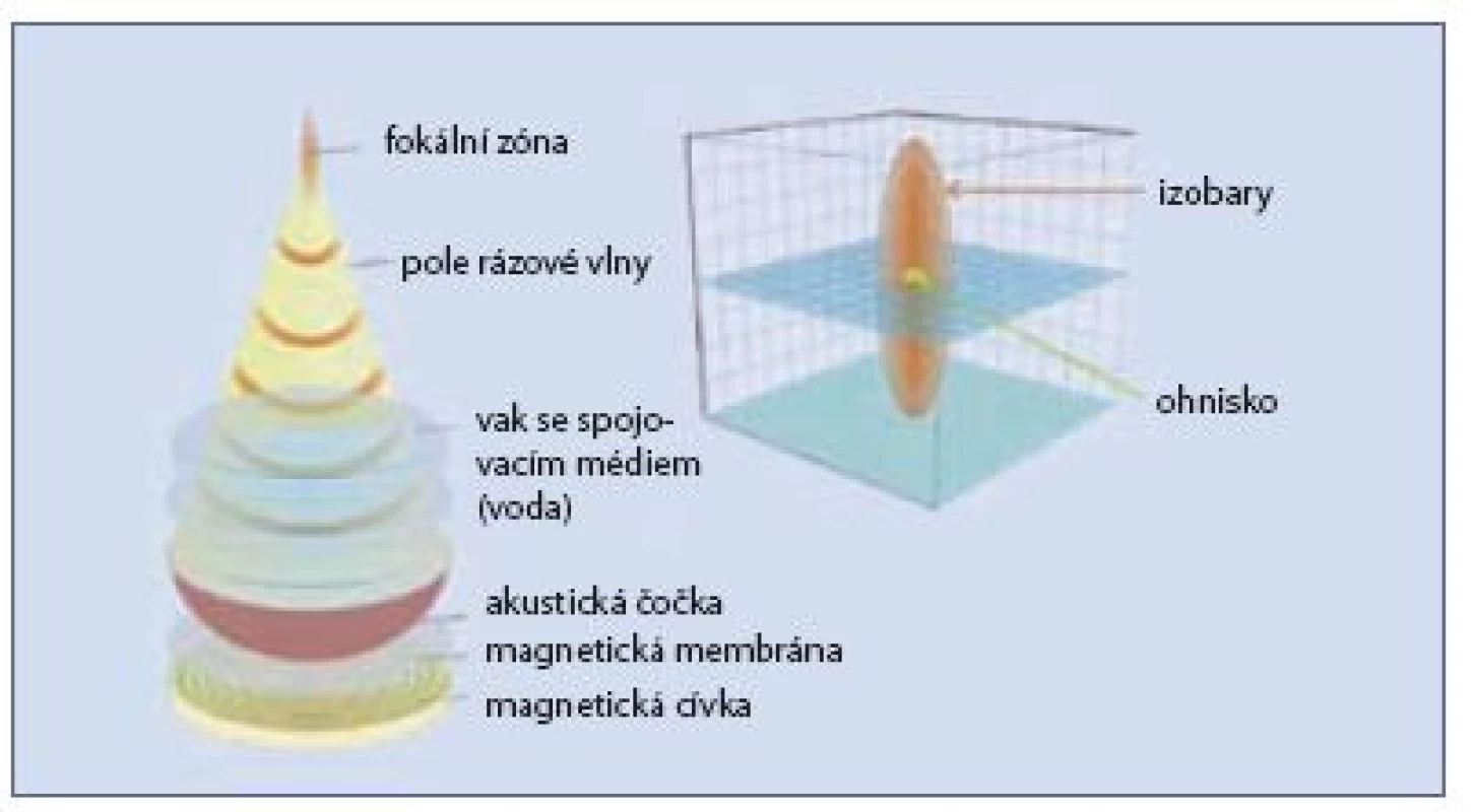Schéma fokální zóny elektromagnetického litotryptoru
Fig. 8 The illustration of the focal zone in electromagnetic lithotripter