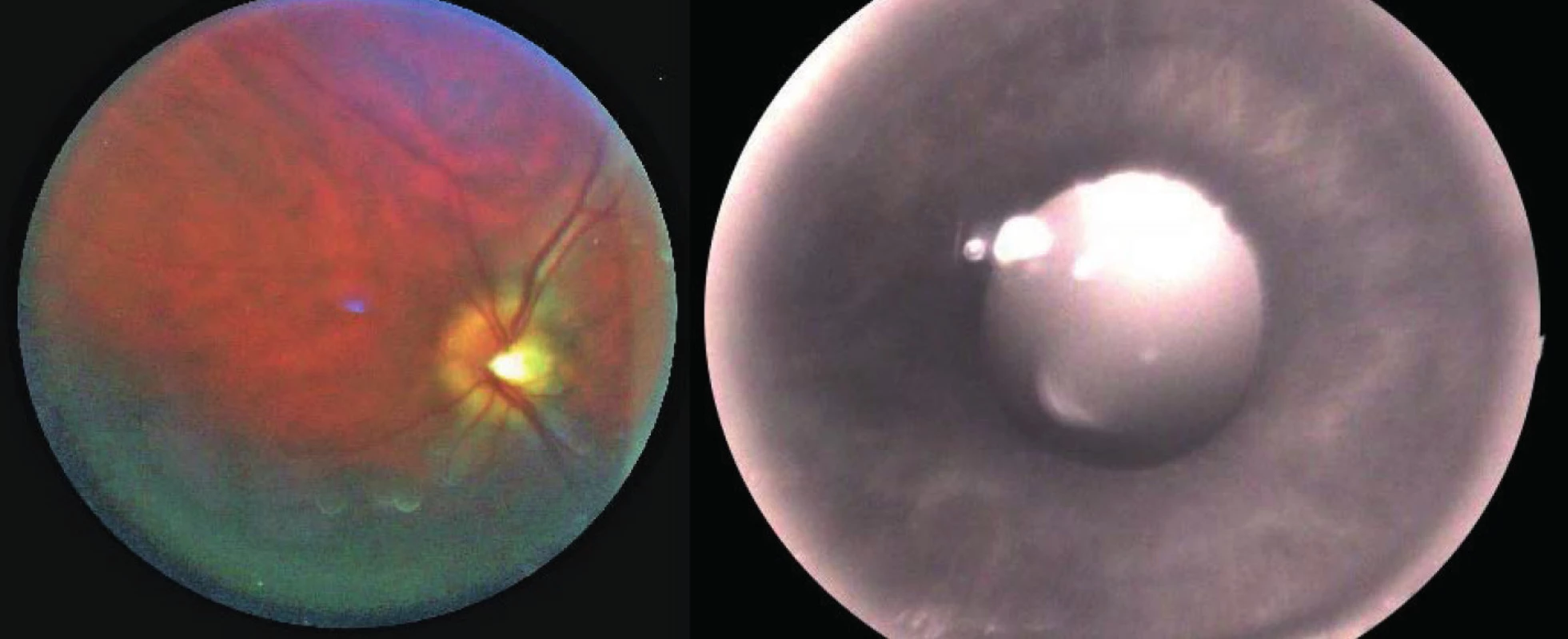 Snímek sítnice (vlevo) a duhovky (vpravo) oka z našeho laboratorního zařízení