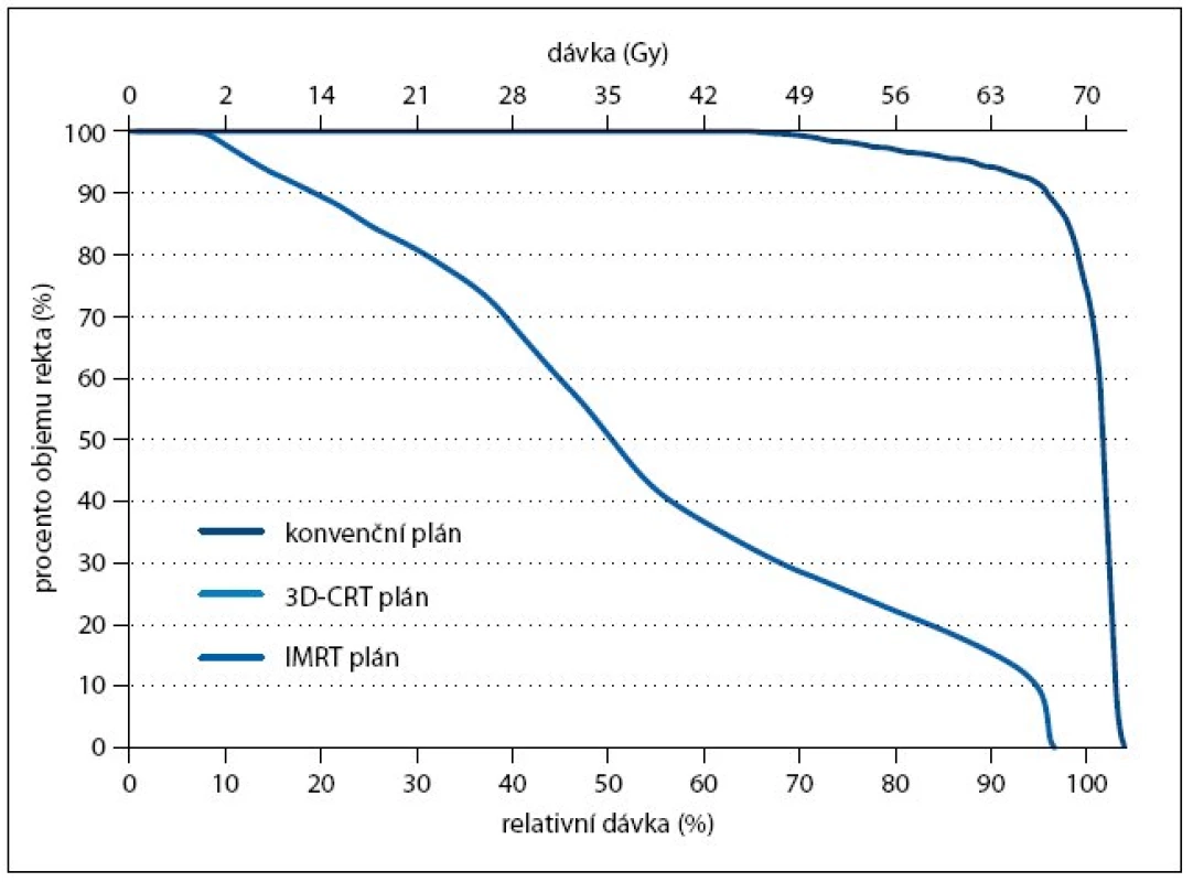 Dávkově-objemový histogram pro rektum.
Porovnání dávkově-objemových histogramů pro rektum při celkové dávce 70 Gy. Znázorněny jsou křivky pro konvenční plán (vpravo), plán konformní (3D-CRT, uprostřed) a plán pro radioterapii s modulovanou intenzitou (IMRT, vlevo).