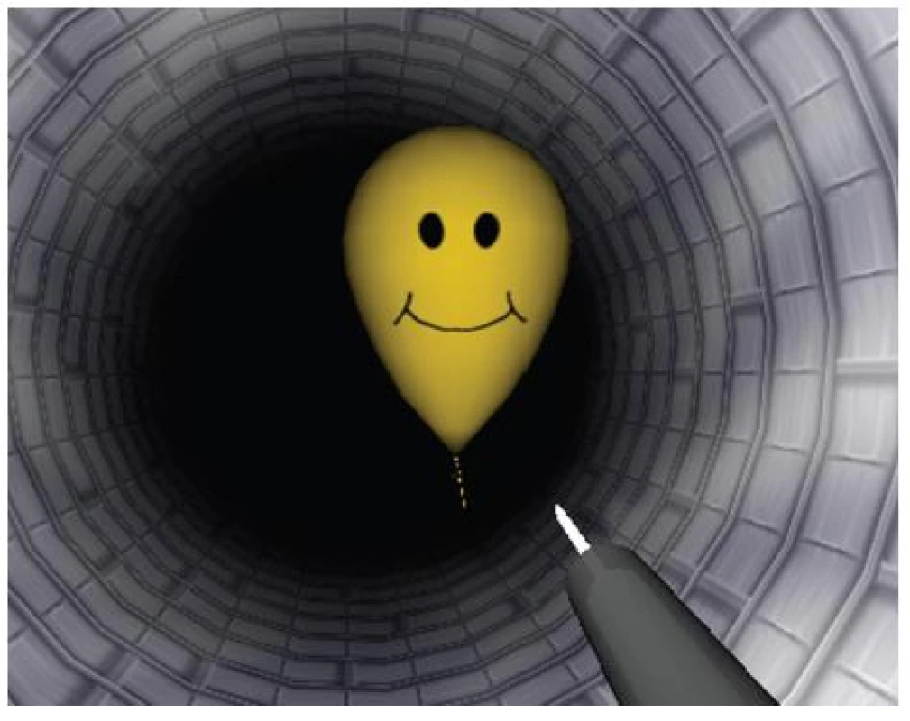 Výcvikový program EndoBubble
Na počítačovém displeji se zobrazuje jehla, kterou je možno navigovat tunelem pomocí endoskopu. Úkolem výcviku je dotknout se jehlou a propíchnout balonky, které se v tunelu vznášejí.