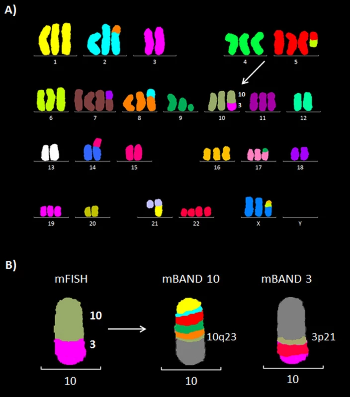 Molekulárně cytogenetická analýza buněčné linie K562. A) Mnohobarevná fluorescenční in situ hybridizace (mFISH). B) Mnohobarevné pruhování s vysokou rozlišovací schopností (mBAND) pro chromozomy 10 a 3.