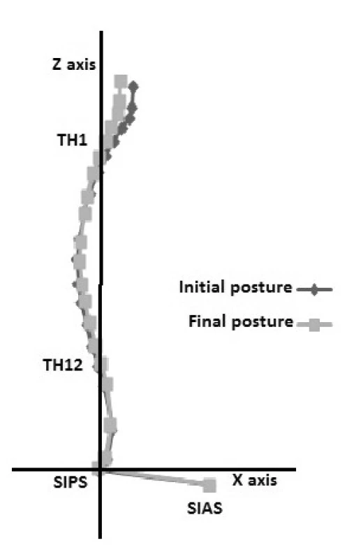 Syndrom otevřených nůžek, osa Z neprochází SIPS-TH12-TH1, počáteční poloha (initial posture), konečná poloha (final posture), osa X (X axis), osa Z (Z axis).