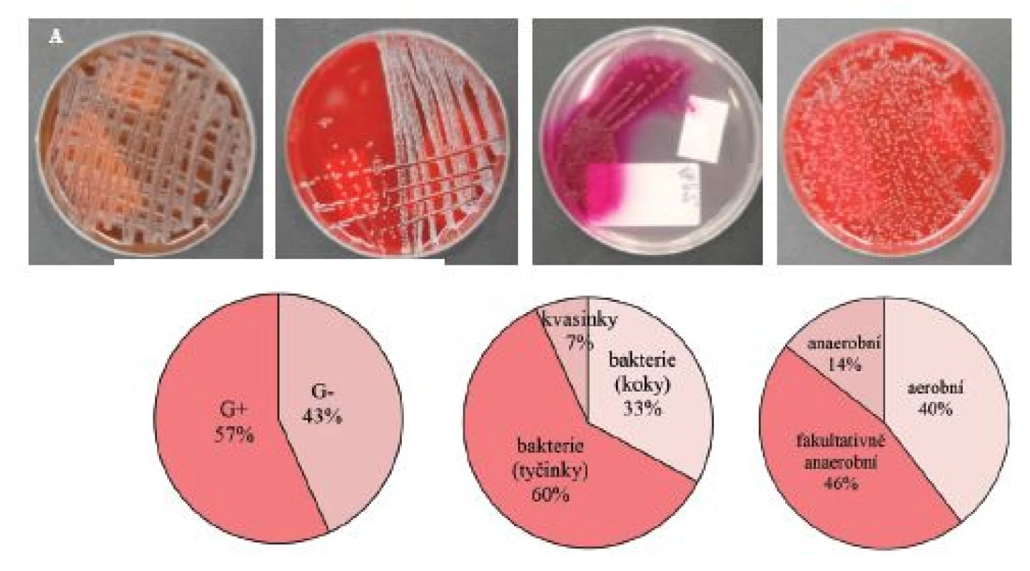A – selektivní kultivace bakteriálních kmenů a kvasinek ve stěrech z infekčních ran pacientů se závažnými, těžce hojitelnými bakteriálními infekcemi, typické nárůsty bakteriálních kultur na jednotlivých selektivních agarech; B – zastoupení G&lt;sup&gt;+&lt;/sup&gt; a G&lt;sup&gt;–&lt;/sup&gt; izolovaných a charakterizovaných bakteriálních kmenů; C – zastoupení koků, tyčinek a kvasinek; D – zastoupení aerobních, fakultativně anaerobních a anaerobních bakterií. Ve studii bylo analyzováno (n = 450) stěrů z nehojících se ran. Identifikace bakteriálních kmenů byla provedena na MALDI MS detektoru (více podrobností v materiálech a metodách a práci (7))