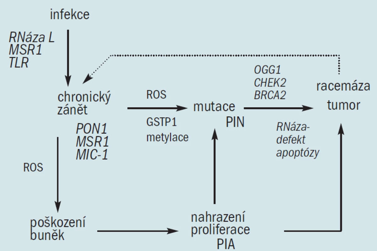 Model patogeneze karcinomu prostaty vázaný na genetickou náchylnost, infekci a chronický zánět. Některé varianty genů náchylnosti ke karcinomu prostaty predisponují k infekci a různé defekty buněčné obrany proti oxidačními stresu, vyvolaného infekcí a jinými zdroji, vedou k nahrazení hyperproliferace (histologicky manifestované jako PIA), mutacím (histologicky manifestované jako PIN) a ke vzniku karcinomu. Tento proces je pravděpodobně podpořen dalšími zdroji oxidačního stresu jako je dietní a environmentální vliv.
PIA = proliferative inflammatory atrophy/proliferační zánětlivá atrofie
PIN = prostate intraepithelial neoplasy/prostatická intraepiteliální neoplazie