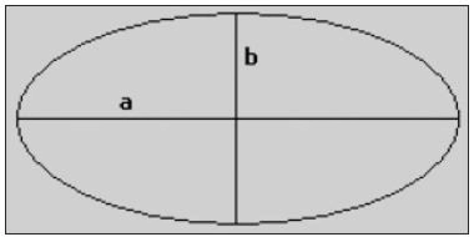 Obecný tvar elipsy (a – hlavní poloosa, b – vedlejší poloosa)
zdroj: http://antisprti.wz.cz/matika/index.php?stranka=elipsa.php&amp;otevreno=elipsa [cit. 21-07-2011]