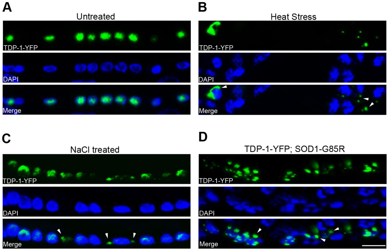 <i>C. elegans</i> TDP-1 forms cytoplasmic granules in neurons under proteotoxic stress.