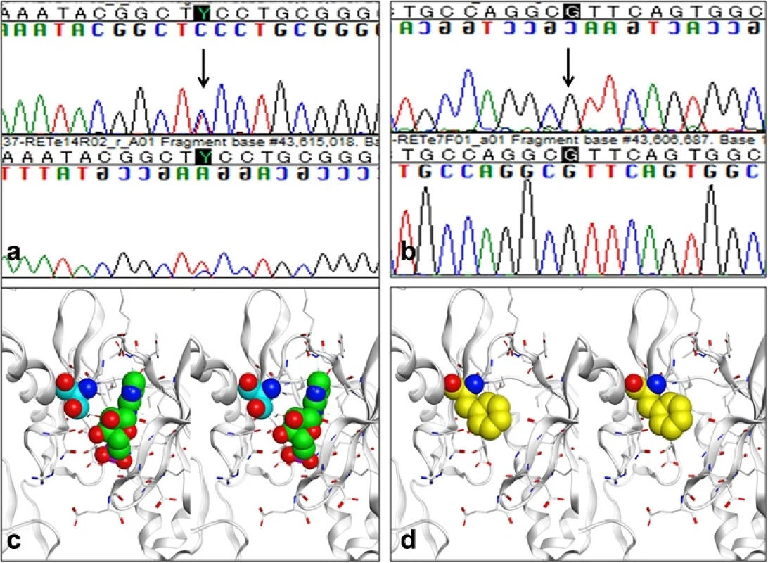 Ret gene analysis (a and b) and molecular models of the ATP binding site in the RET tyrosine kinase domain as well as a S811F mutant (c and d). In exon 14, heterozygous substitution mutation from TCC to TTC, changing serine to phenylalanine, was detected (p.S811F) (a, indicated by arrow), while the nucleotide at 1476 position was G (b, indicated by arrow). A molecular model of the ATP-binding site according to X-ray crystallography of the RET tyrosine kinase domain-AMP complex (Protein Data Bank; 2IVT) is shown in (c) 3-dimentionally. AMP and Ser811 respectively are represented by green and light blue spheres with some residues surrounding AMP were described by white rods in this molecular cartoon. Oxygen and nitrogen atoms are colored red and blue, respectively. An S811F mutant model was constructed based on the structure above, also is shown (d). Phe811 is depicted in yellow. Molecular modeling operations including display residue substitution, and structural optimization were performed using MOE 2014.09 software (Chemical Computing Group., Montreal, Canada)