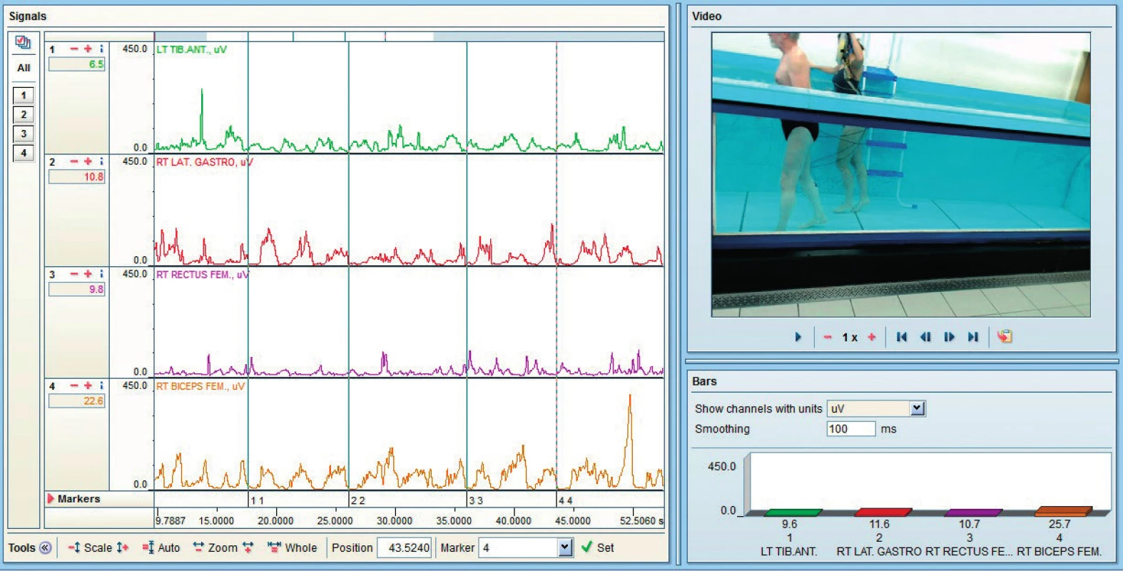 EMG záznam chůze ve vodě