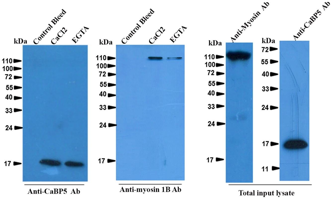 Interaction of EhCaBP5 with myosin 1B.