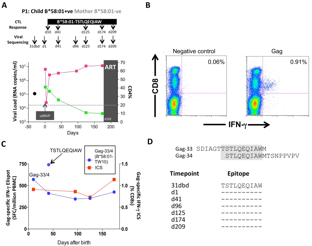Gag-specific CD8+ T-cell responses and autologous viral sequences in a rapid progressing child, P1.