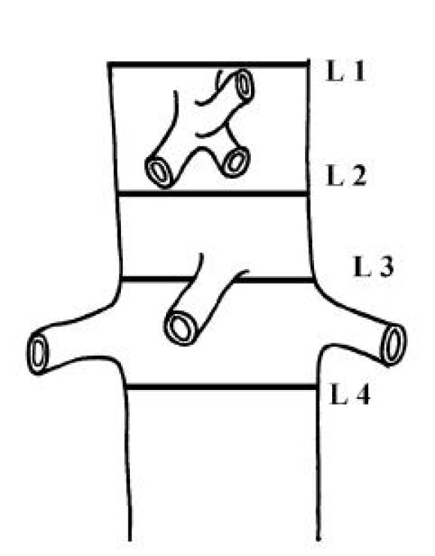 Viscerální aorta – hladiny měření L 1, L 2, L 3 a L 4
Fig. 1. Visceral aorta – measurements at L 1, L 2, L 3 and L 4