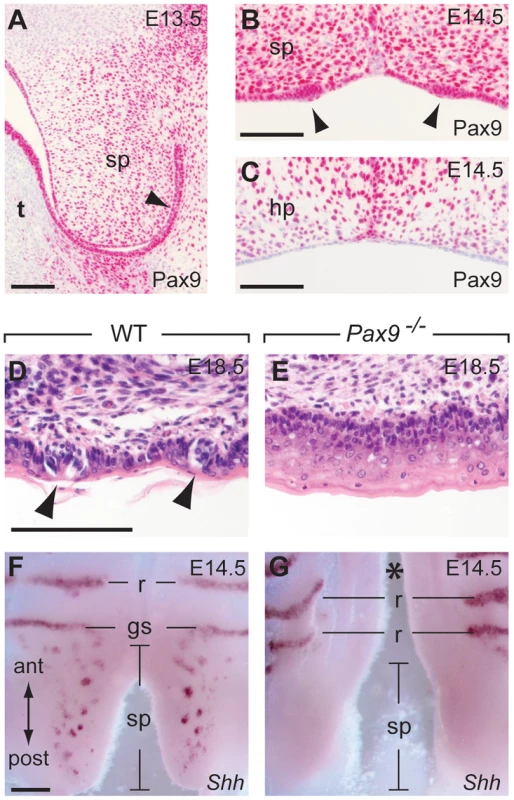 Pax9 is essential for taste placode formation in the soft palate.